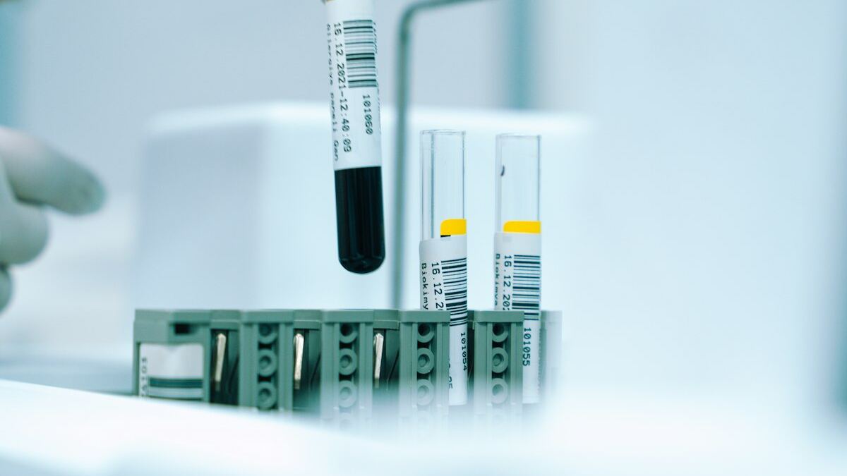Gloved hand holding a labeled sample tube beside a rack of tubes